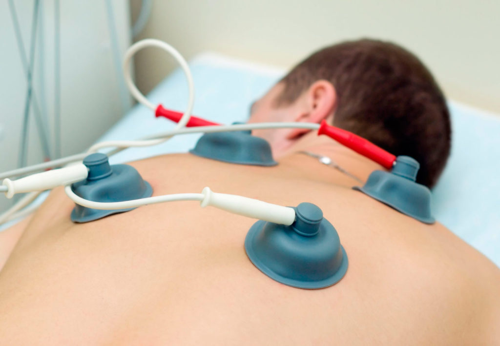 A person receives therapeutic cupping treatment on their back.
